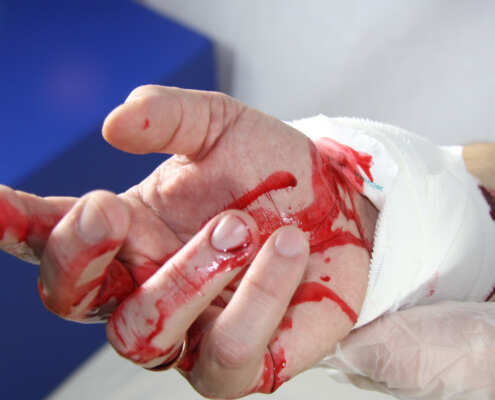 Stop the bleed Security-Service-Schwarzenbek
